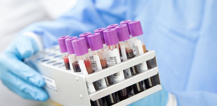 The Top 3 Blood Work Priorities for South Asians